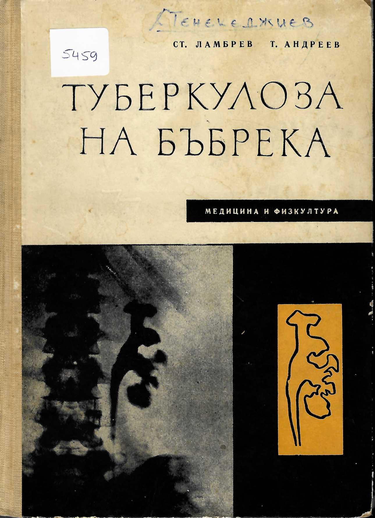  Туберкулоза на бъбрека